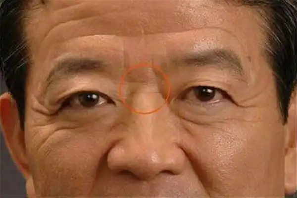 面相，山根低的人運勢是什麼樣呢？